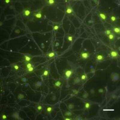 Immunocytochemistry/ Immunofluorescence: FUS Antibody [NB100-565]