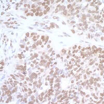 Immunohistochemistry-Paraffin: FUS Antibody [NB100-561]