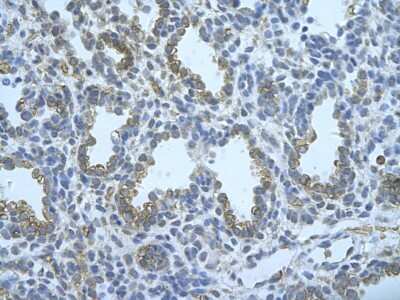 Immunohistochemistry: FUS Antibody [NBP1-57309]