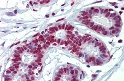 Immunohistochemistry: FUS Antibody [NBP1-57309]