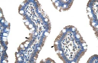 Immunohistochemistry: FUS Antibody [NBP1-57309]