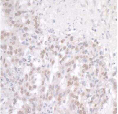 Immunohistochemistry-Paraffin: FUS Antibody [NB100-2599]