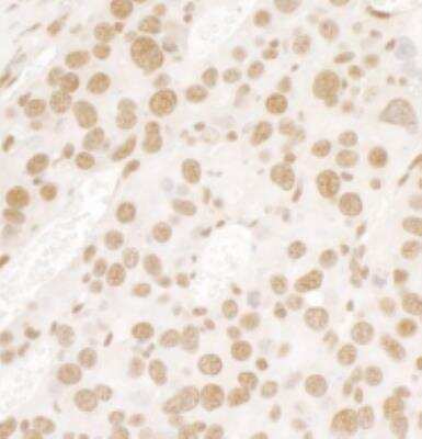 Immunohistochemistry-Paraffin: FUS Antibody [NB100-2599]