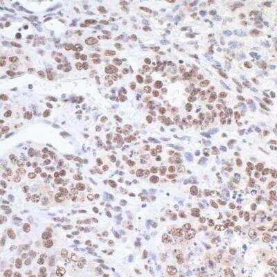 Immunohistochemistry-Paraffin: FUS Antibody [NB100-561]
