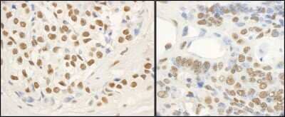 Immunohistochemistry-Paraffin: FUS Antibody [NB100-562]
