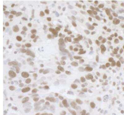 Immunohistochemistry-Paraffin: FUS Antibody [NB100-565]