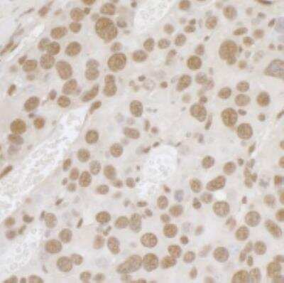 Immunohistochemistry-Paraffin: FUS Antibody [NB100-565]