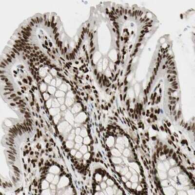 Immunohistochemistry-Paraffin: FUS Antibody [NBP1-89113]