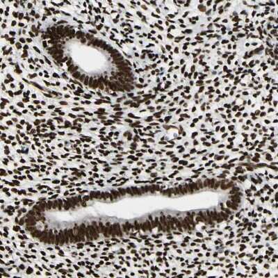 Immunohistochemistry-Paraffin: FUS Antibody [NBP1-89113]