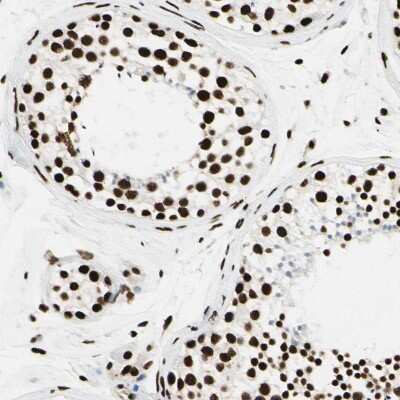 Immunohistochemistry-Paraffin: FUS Antibody [NBP1-89113]