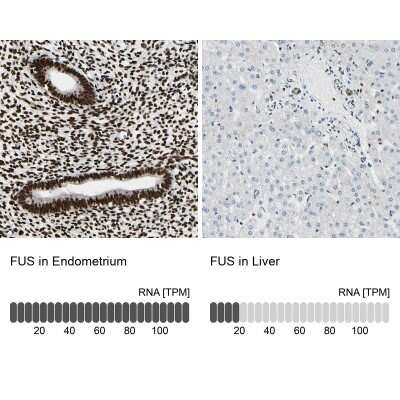 Immunohistochemistry-Paraffin: FUS Antibody [NBP1-89113]