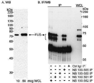 Western Blot: FUS Antibody [NB100-562]