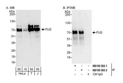 Western Blot: FUS Antibody [NB100-562]