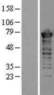 Western Blot: FUS Overexpression Lysate [NBL1-10861]