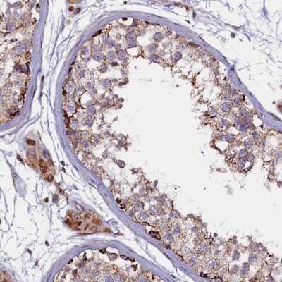 Immunohistochemistry-Paraffin: FUS2 Antibody [NBP1-89812]