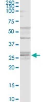 Western Blot: FUS2 Antibody [H00024142-D01P]