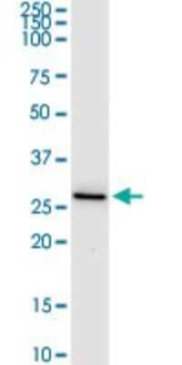 Western Blot: FUS2 Antibody [H00024142-D01P]