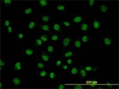 Immunocytochemistry/ Immunofluorescence: FUSIP1 Antibody (1A6) [H00010772-M03]