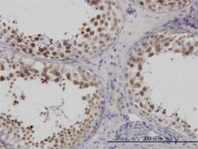 Immunohistochemistry-Paraffin: FUSIP1 Antibody (1A6) [H00010772-M03]