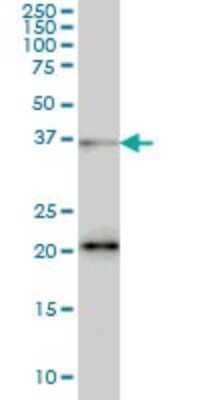 Western Blot: FUSIP1 Antibody (1A6) [H00010772-M03]