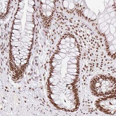 Immunocytochemistry/ Immunofluorescence: FUSIP1 Antibody [NBP2-46818]