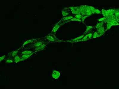 Immunocytochemistry/ Immunofluorescence: FUSIP1 Antibody [NBP2-97993]