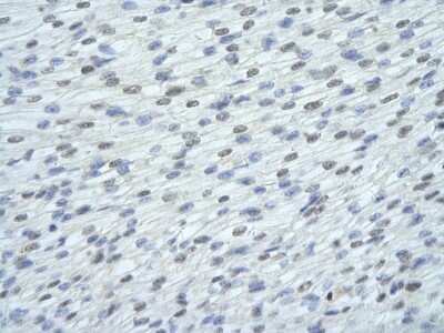 Immunohistochemistry: FUSIP1 Antibody [NBP1-57428]