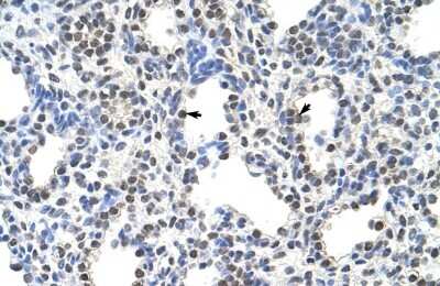 Immunohistochemistry: FUSIP1 Antibody [NBP1-57428]