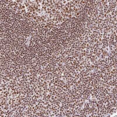 Immunohistochemistry: FUSIP1 Antibody [NBP2-46818]
