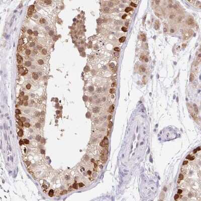 Immunohistochemistry-Paraffin: FUSIP1 Antibody [NBP2-46815]