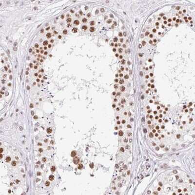 Immunohistochemistry-Paraffin: FUSIP1 Antibody [NBP2-46818]