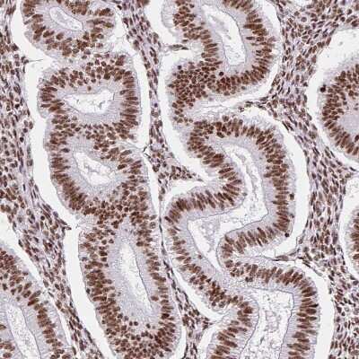 Immunohistochemistry-Paraffin: FUSIP1 Antibody [NBP2-46818]