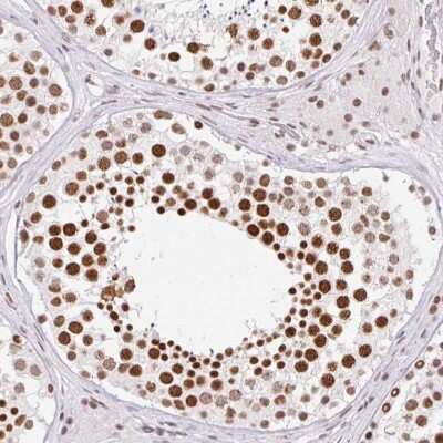 Immunohistochemistry-Paraffin: FUSIP1 Antibody [NBP2-46818]