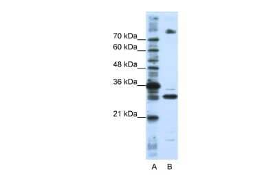 Western Blot: FUSIP1 Antibody [NBP1-57428]