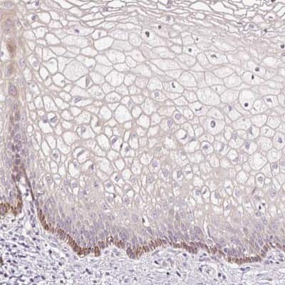 Immunohistochemistry-Paraffin: FUT10 Antibody [NBP2-31571]