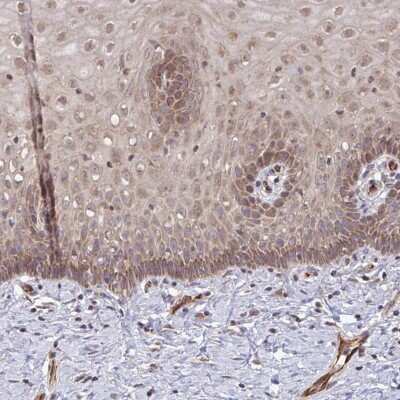 Immunohistochemistry-Paraffin: FUT10 Antibody [NBP2-31724]