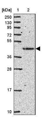 Western Blot: FUT10 Antibody [NBP2-31571]