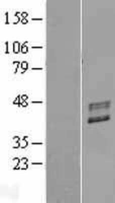 Western Blot: Fucosyltransferase 2/FUT2 Overexpression Lysate [NBP2-09014]