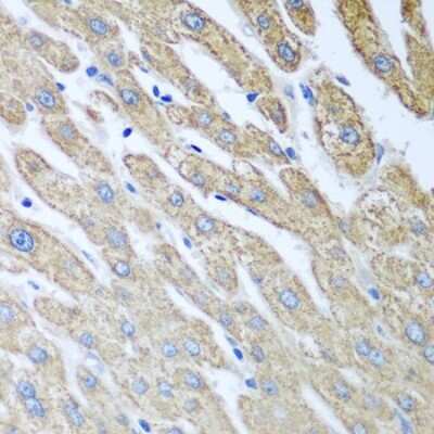 Immunohistochemistry-Paraffin: FUT6 Antibody - BSA Free [NBP3-04778]