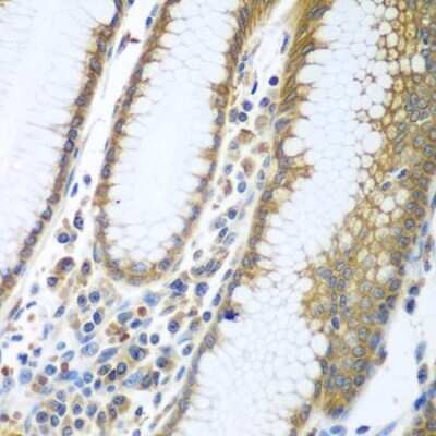 Immunohistochemistry-Paraffin: FUT6 Antibody - BSA Free [NBP3-04778]