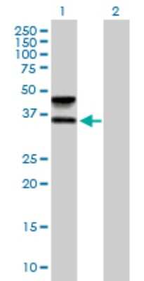 Western Blot: FUT6 Antibody [H00002528-B01P]