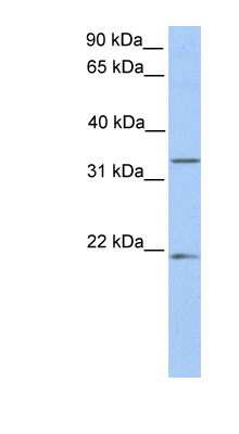 Western Blot: FUT6 Antibody [NBP1-57936]