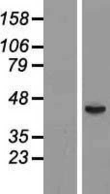 Western Blot: FUT6 Overexpression Lysate [NBL1-10866]