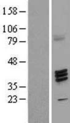 Western Blot: Fucosyltransferase 7/FUT7 Overexpression Lysate [NBL1-10867]