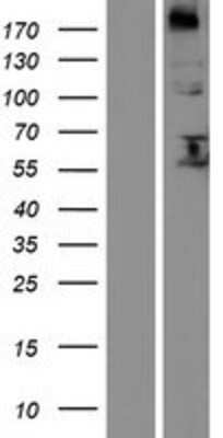 Western Blot: Fucosyltransferase 8/FUT8 Overexpression Lysate [NBP2-04985]