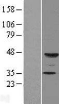 Western Blot: FUT9 Overexpression Lysate [NBL1-10868]