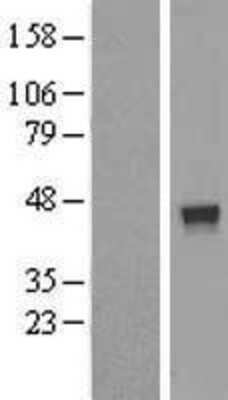 Western Blot: FUZ Overexpression Lysate [NBL1-10869]