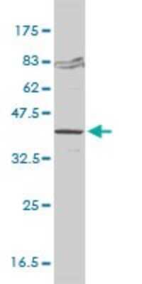 Western Blot: FVT1 Antibody (2B2-3C11) [H00002531-M01]