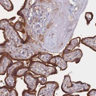 Immunohistochemistry: FVT1 Antibody [NBP2-38534]