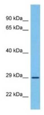 Western Blot: FVT1 Antibody [NBP3-10091]